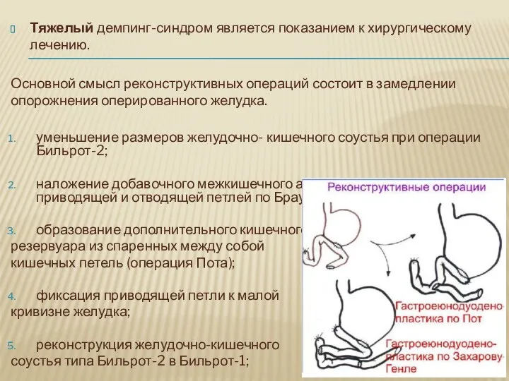 Тяжелый демпинг-синдром является показанием к хирургическому лечению. Основной смысл реконструктивных