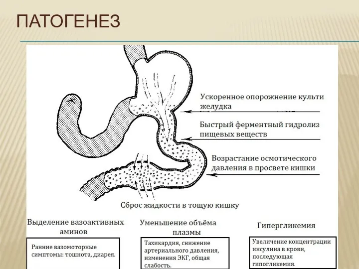 ПАТОГЕНЕЗ