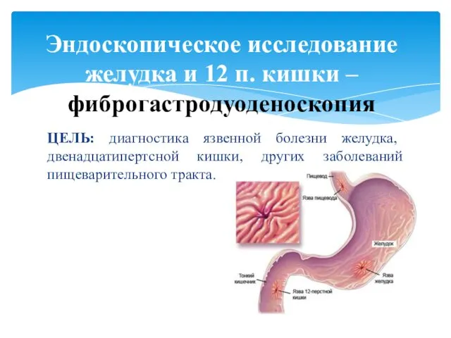 ЦЕЛЬ: диагностика язвенной болезни желудка, двенадцатипертсной кишки, других заболеваний пищеварительного тракта. Эндоскопическое исследование