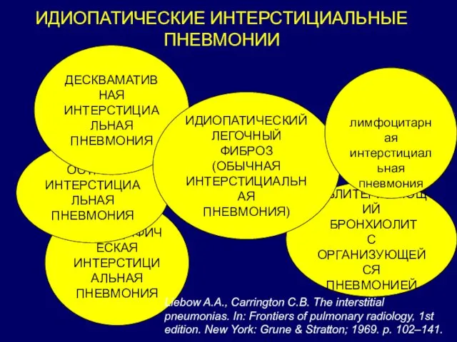 НЕСПЕЦИФИЧЕСКАЯ ИНТЕРСТИЦИАЛЬНАЯ ПНЕВМОНИЯ Лимфоцитарная ИДИОПАТИЧЕСКИЕ ИНТЕРСТИЦИАЛЬНЫЕ ПНЕВМОНИИ Liebow A.A., Carrington C.B. The interstitial