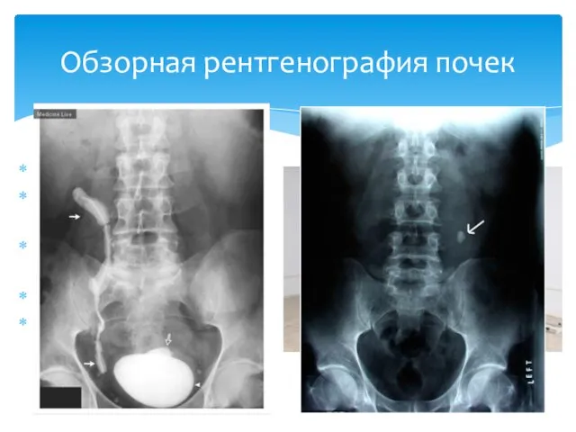 Беcконтрастная Rg Зармеры и расположение, камни Патологии органов брюшной полости