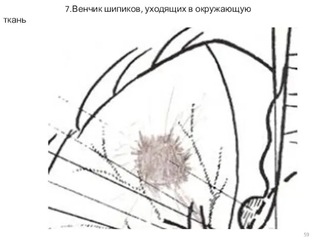 7.Венчик шипиков, уходящих в окружающую ткань