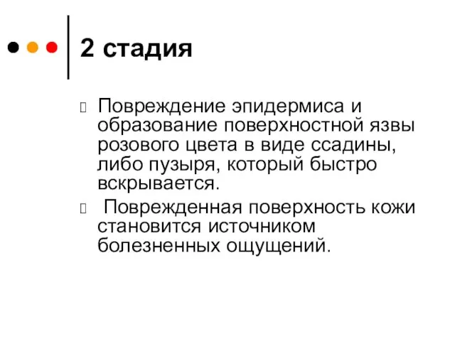 2 стадия Повреждение эпидермиса и образование поверхностной язвы розового цвета в виде ссадины,