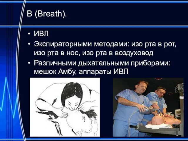 В (Breath). ИВЛ Экспираторными методами: изо рта в рот, изо рта в нос,