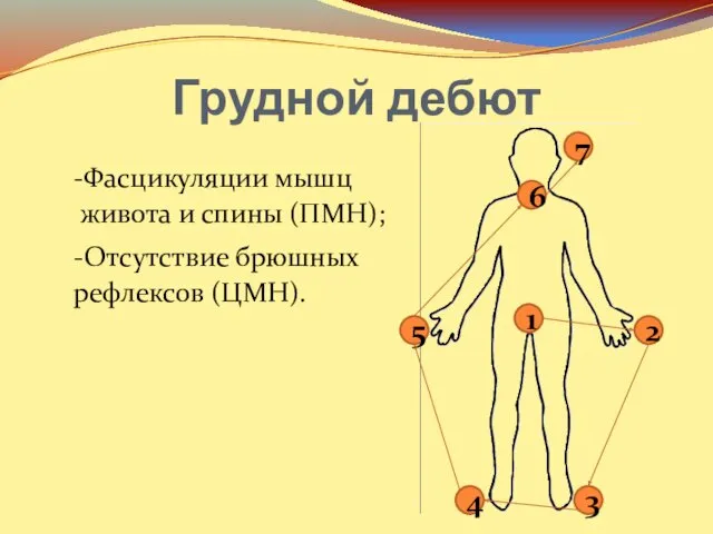 Грудной дебют 7 6 5 4 3 2 1 -Фасцикуляции