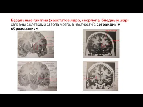 Базальные ганглии (хвостатое ядро, скорлупа, бледный шар) связаны с клетками ствола мозга, в