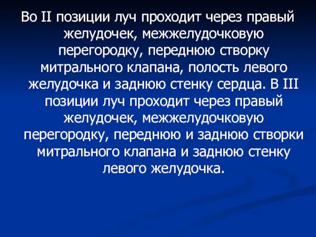 Во II позиции луч проходит через правый желудочек, межжелудочковую перегородку,