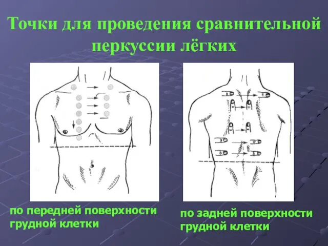 Точки для проведения сравнительной перкуссии лёгких по передней поверхности грудной клетки по задней поверхности грудной клетки