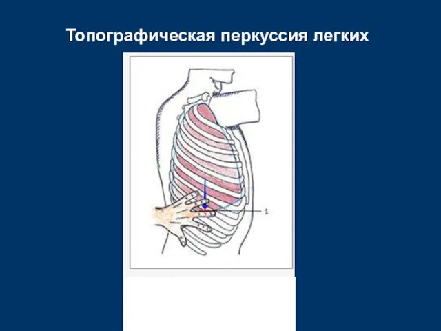 Топографическая перкуссия легких