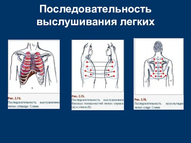 Последовательность выслушивания легких