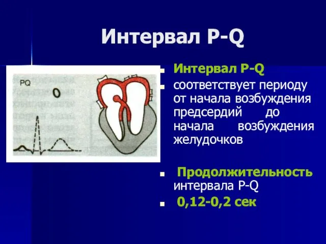 Интервал Р-Q Интервал Р-Q соответствует периоду от начала возбуждения предсердий