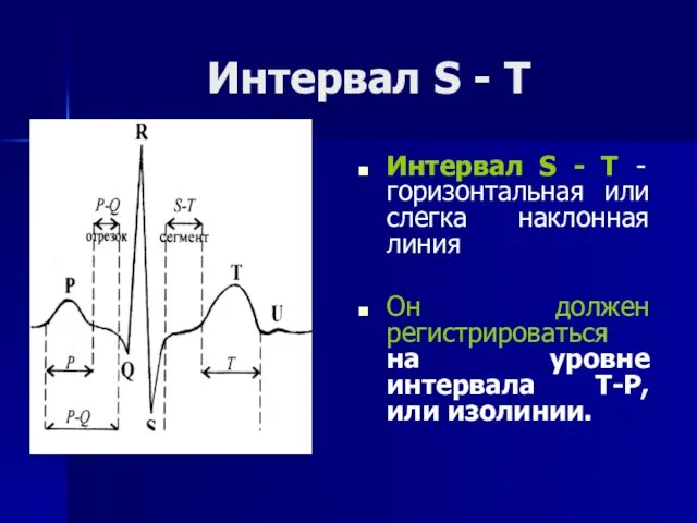 Интервал S - Т Интервал S - Т - горизонтальная