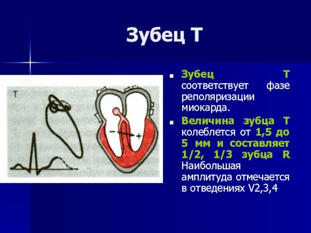 Зубец Т Зубец Т соответствует фазе реполяризации миокарда. Величина зубца