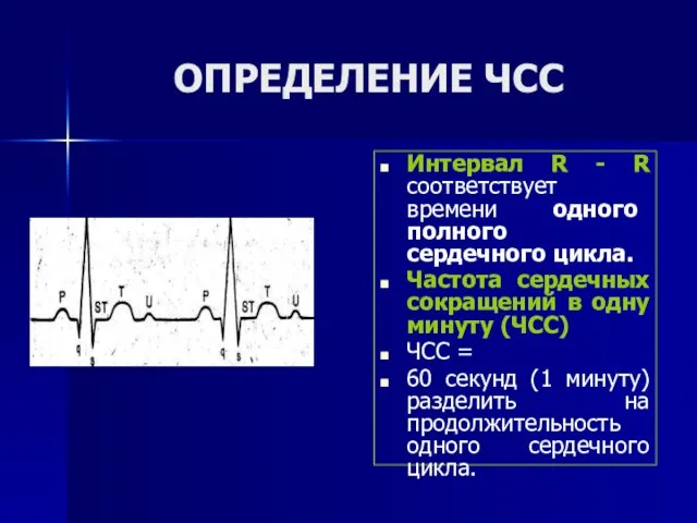 ОПРЕДЕЛЕНИЕ ЧСС Интервал R - R соответствует времени одного полного