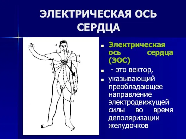 ЭЛЕКТРИЧЕСКАЯ ОСЬ СЕРДЦА Электрическая ось сердца (ЭОС) - это вектор,