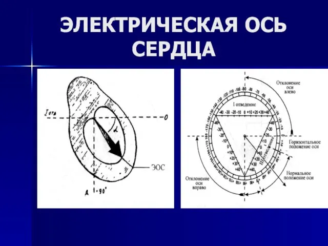 ЭЛЕКТРИЧЕСКАЯ ОСЬ СЕРДЦА