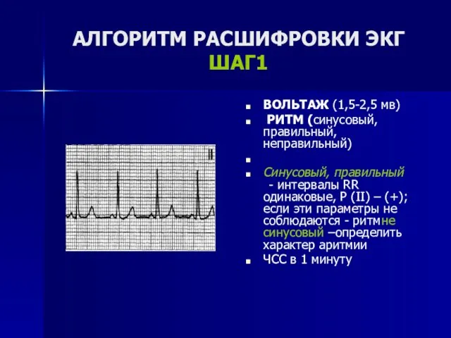 АЛГОРИТМ РАСШИФРОВКИ ЭКГ ШАГ1 ВОЛЬТАЖ (1,5-2,5 мв) РИТМ (синусовый, правильный,