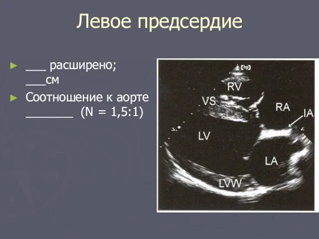 Левое предсердие ___ расширено; ___см Соотношение к аорте _______ (N = 1,5:1)