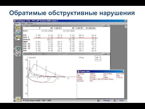 Обратимые обструктивные нарушения