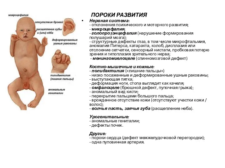 ПОРОКИ РАЗВИТИЯ Нервная система: - отклонения психического и моторного развития;