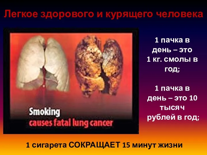 Легкое здорового и курящего человека 1 сигарета СОКРАЩАЕТ 15 минут
