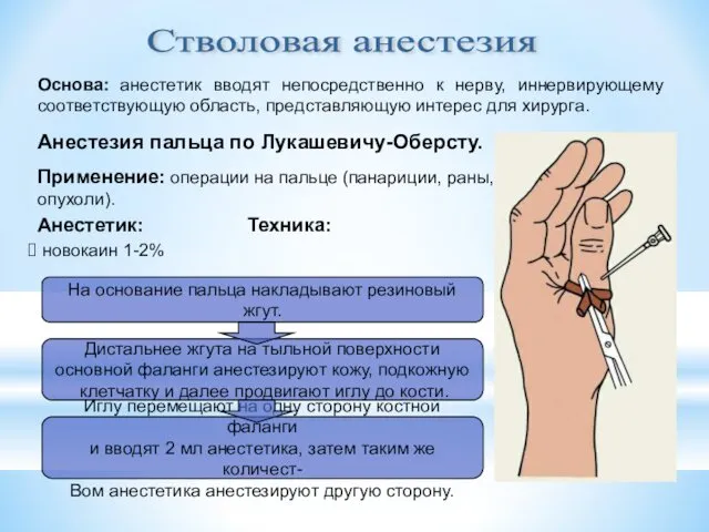 Стволовая анестезия Основа: анестетик вводят непосредственно к нерву, иннервирующему соответствующую