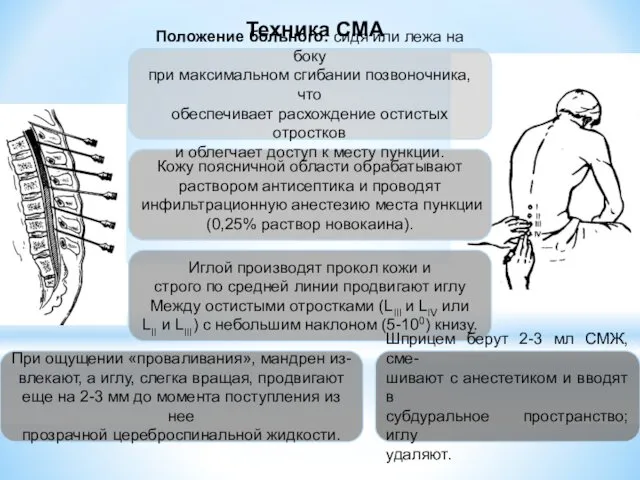 Техника СМА