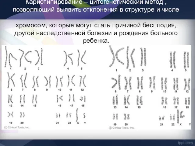 Кариотипирование – цитогенетический метод , позволяющий выявить отклонения в структуре