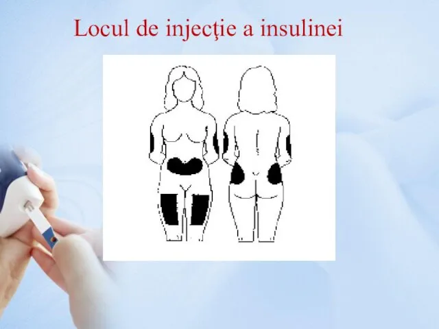 Locul de injecţie a insulinei