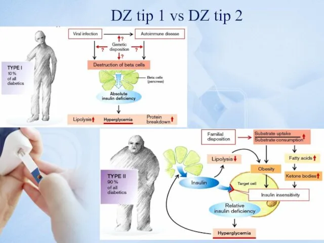 DZ tip 1 vs DZ tip 2