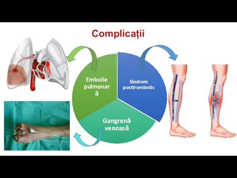 Complicații