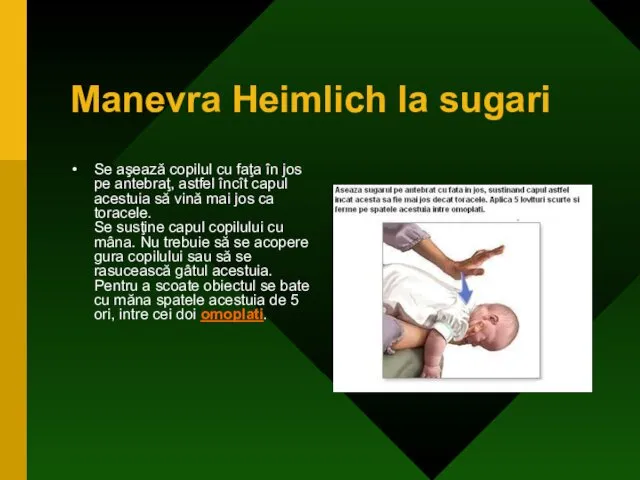 Manevra Heimlich la sugari Se aşează copilul cu faţa în