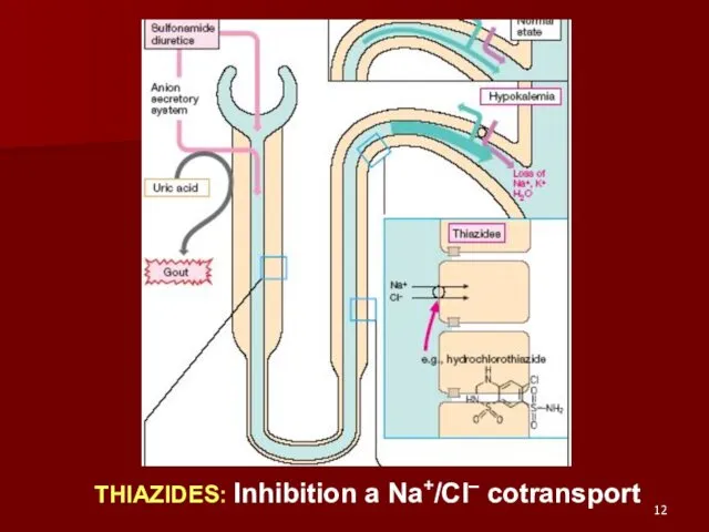 THIAZIDES: Inhibition a Na+/Cl– cotransport