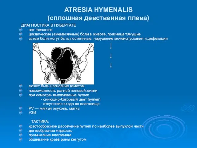 ATRESIA HYMENALIS (сплошная девственная плева) ДИАГНОСТИКА В ПУБЕРТАТЕ нет menarche