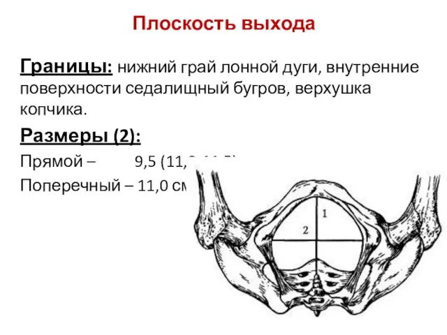 Плоскость выхода Границы: нижний грай лонной дуги, внутренние поверхности седалищный