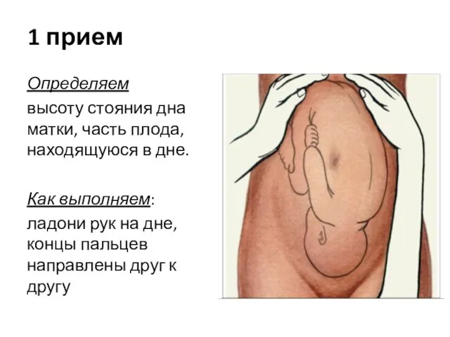 1 прием Определяем высоту стояния дна матки, часть плода, находящуюся