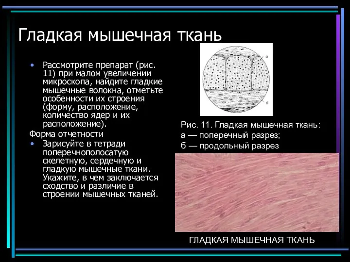 Гладкая мышечная ткань Рассмотрите препарат (рис. 11) при малом увеличении