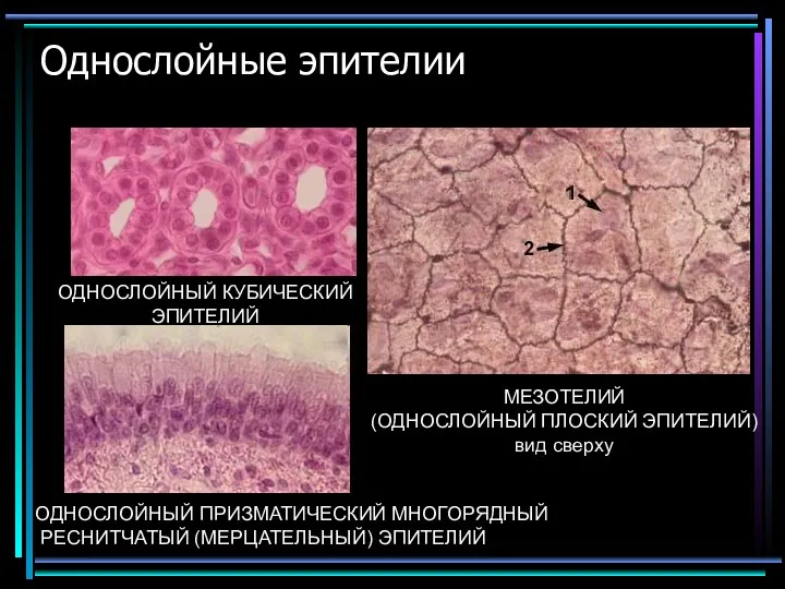 Однослойные эпителии ОДНОСЛОЙНЫЙ КУБИЧЕСКИЙ ЭПИТЕЛИЙ МЕЗОТЕЛИЙ (ОДНОСЛОЙНЫЙ ПЛОСКИЙ ЭПИТЕЛИЙ) вид