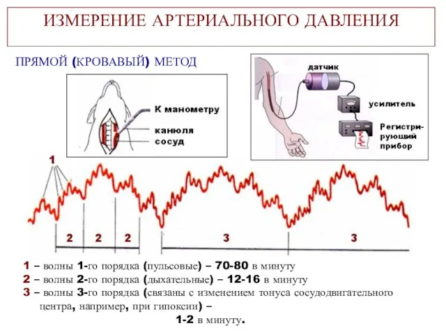 ИЗМЕРЕНИЕ АРТЕРИАЛЬНОГО ДАВЛЕНИЯ ПРЯМОЙ (КРОВАВЫЙ) МЕТОД 1 – волны 1-го