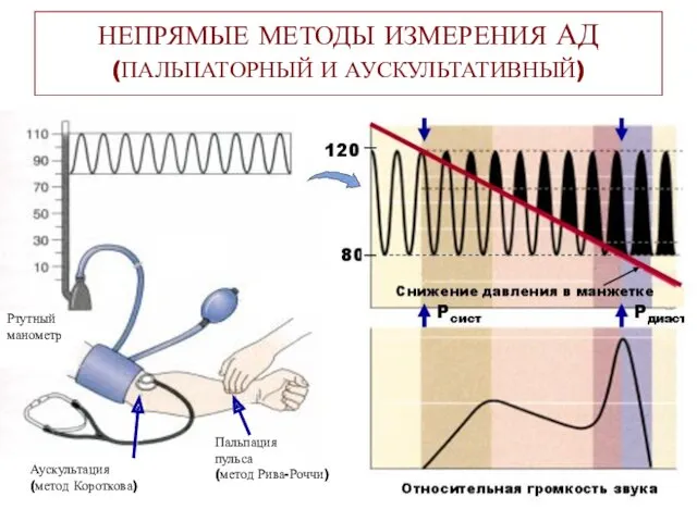 НЕПРЯМЫЕ МЕТОДЫ ИЗМЕРЕНИЯ АД (ПАЛЬПАТОРНЫЙ И АУСКУЛЬТАТИВНЫЙ) Пальпация пульса (метод Рива-Роччи) Аускультация (метод Короткова) Ртутный манометр