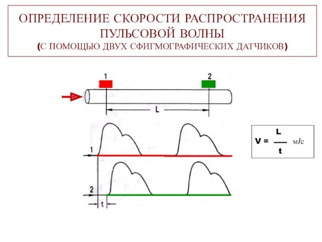 ОПРЕДЕЛЕНИЕ СКОРОСТИ РАСПРОСТРАНЕНИЯ ПУЛЬСОВОЙ ВОЛНЫ (С ПОМОЩЬЮ ДВУХ СФИГМОГРАФИЧЕСКИХ ДАТЧИКОВ) L V = м/с t