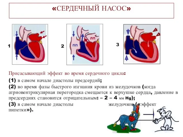 Присасывающий эффект во время сердечного цикла: (1) в самом начале