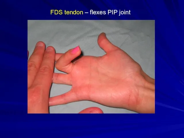FDS tendon – flexes PIP joint