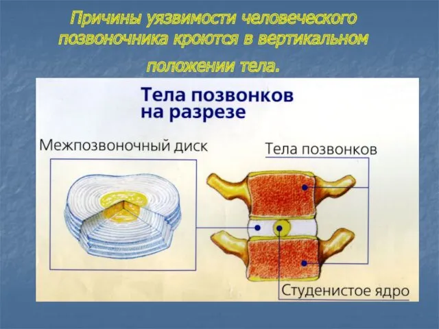 Причины уязвимости человеческого позвоночника кроются в вертикальном положении тела.