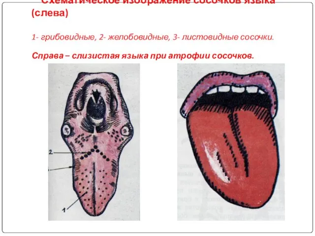 Схематическое изображение сосочков языка (слева) 1- грибовидные, 2- желобовидные, 3- листовидные сосочки. Справа