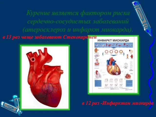 Курение является фактором риска сердечно-сосудистых заболеваний (атеросклероз и инфаркт миокарда).