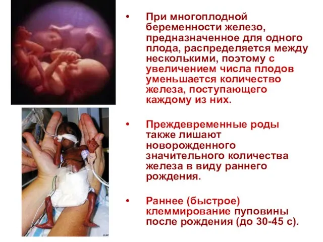 При многоплодной беременности железо, предназначенное для одного плода, распределяется между