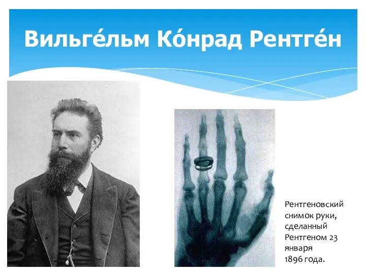 Вильге́льм Ко́нрад Рентге́н Рентгеновский снимок руки, сделанный Рентгеном 23 января 1896 года.