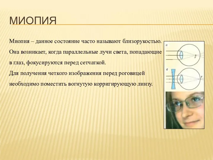 МИОПИЯ Миопия – данное состояние часто называют близорукостью. Она возникает,