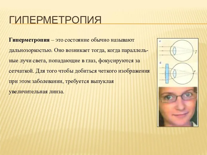 ГИПЕРМЕТРОПИЯ Гиперметропия – это состояние обычно называют дальнозоркостью. Оно возникает